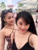 Phẫu thuật hàm hô an toàn tphcm
