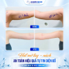 Tay Thon – Nách Gọn: Bí Quyết Diện Đồ Đẹp Không Cần Che Giấu