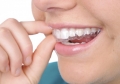 Chỉnh nha là gì và các phương pháp chỉnh nha hiện nay