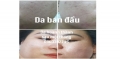 Top 3 Kem Dưỡng Trắng Da Mặt Tốt Và An Toàn Nhất 2021
