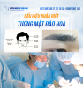 Tướng mặt đào hoa