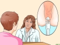 Kinh nghiệm đi cắt trĩ an toàn hiệu quả
