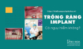 Trồng răng Implant có đau không? Giải đáp mọi thắc mắc trước khi quyết định