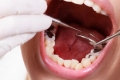Nha sĩ chia sẻ gì về vấn đề hàn răng trẻ em