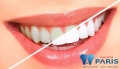 Tổng hợp 5 cách tẩy trắng răng tại nhà hiệu quả nhất
