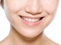 Tham khảo thông tin về số tiền của dịch vụ chỉnh nha trên địa bàn Hà Nội