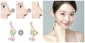 nâng mũi cấu trúc