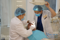 Giải mã về răng sâu - Nhổ răng sâu chỉ còn chân răng