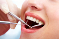 Sưng mặt, đau nhức sau nhổ răng khôn - Nguyên nhân và cách xử lý